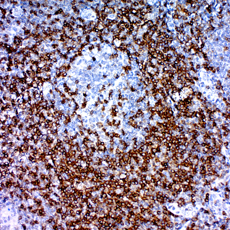 CD45RO, T-Cell; Clone UCHL1 (Concentrate)
